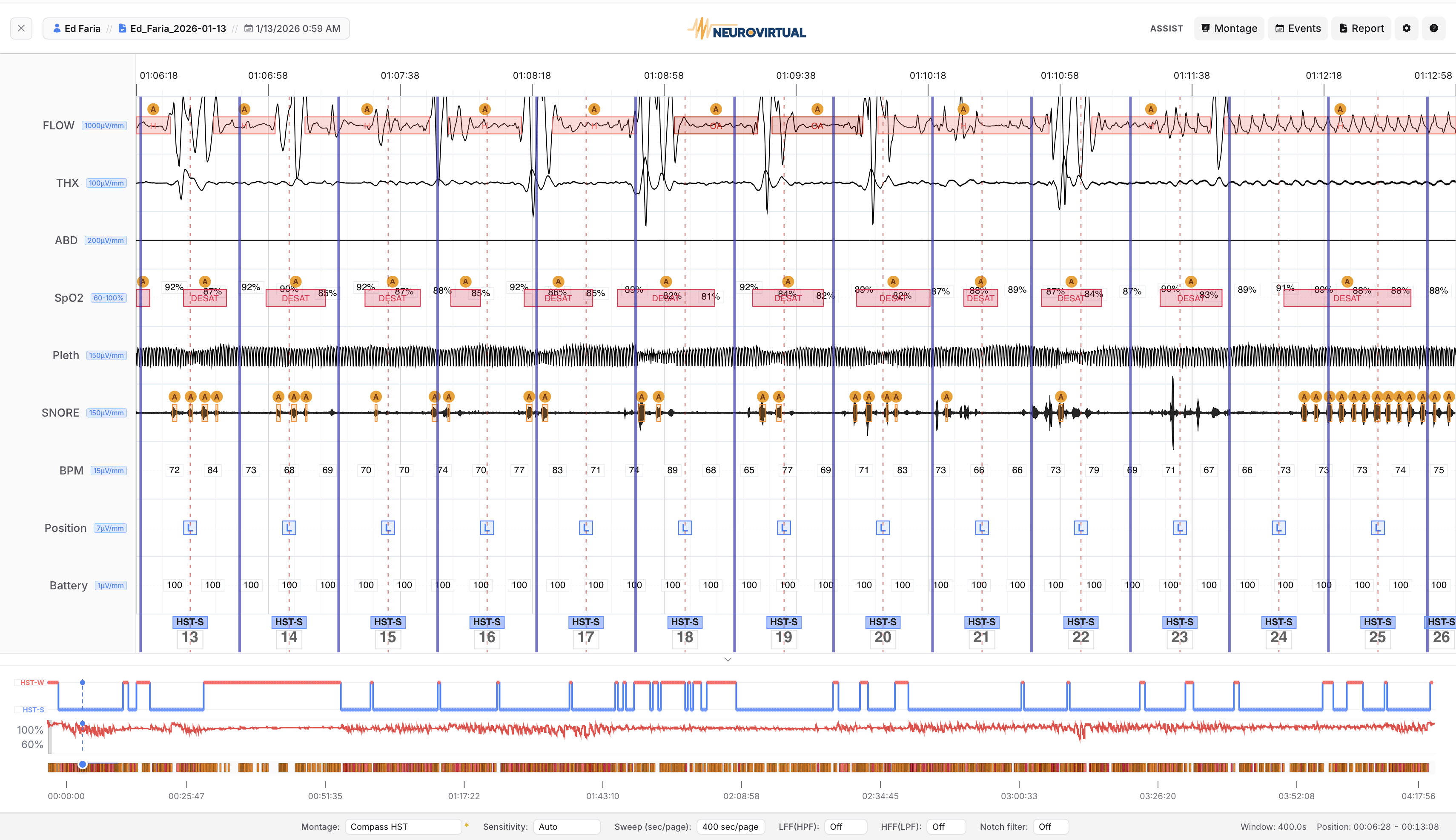 Neurovirtual Portal wave viewer showing a scored HST study